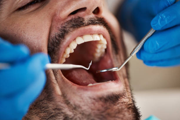 Best Broken Tooth Emergency  in Yarmouth Port, MA